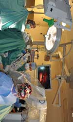 Robotic SS Hysterectomy